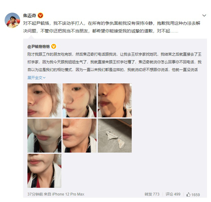 《快男》尹毓恪控诉遭焦迈奇施暴 拿碗砸脸打巴掌
