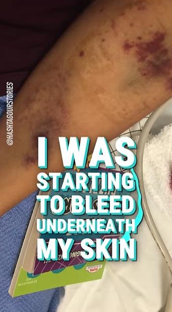 视频 | 双脚满是红点去检查·少女才19岁被迫停经！