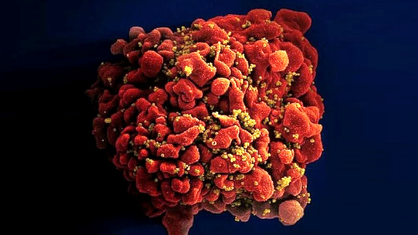 New ‘highly virulent’ HIV strain discovered in the Netherlands