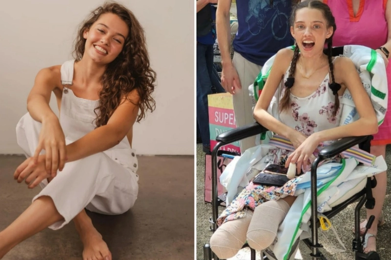 21岁女模因冠病并发症双腿截肢 住院2个多月乐观返家庆生