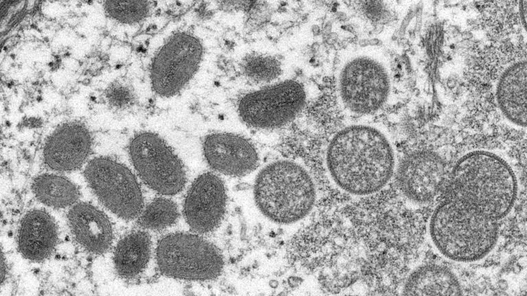 欧洲疾控：全球非猴痘原始流行地区确诊超过200例