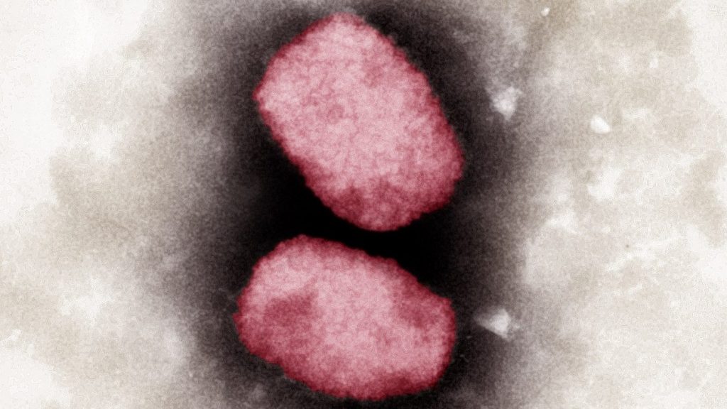 潜在猴痘疫苗 莫德纳进行临床前试验