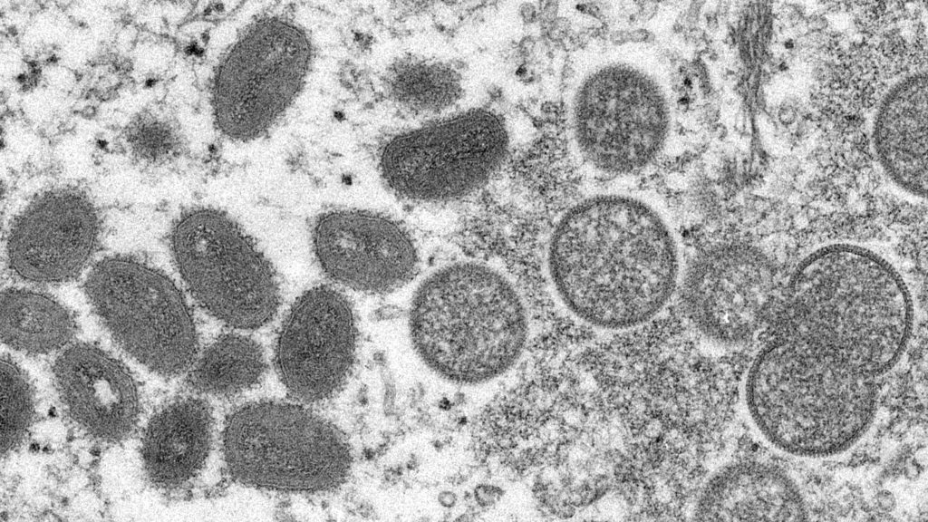 猴痘疫情蔓延    以色列和瑞士首现个案　