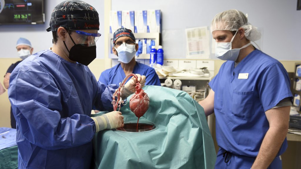 病人术后存活约两个月 首例人体移植猪心脏携病毒