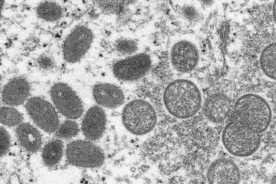 美疾控中心在释放一批天花疫苗应对猴痘疫情