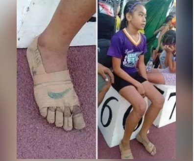 菲11岁女童没钱买鞋 “脚缠绷带”跑出3金