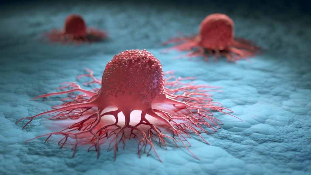 革命性“癌症病毒”展开人体实验　能有效缩小肺部、卵巢肿瘤