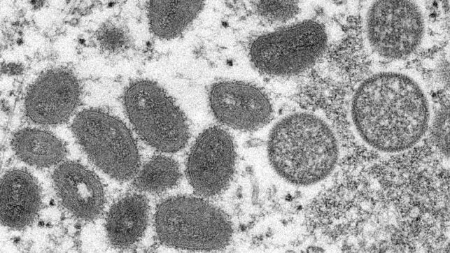世界卫生组织：猴痘出现社区传播迹象
