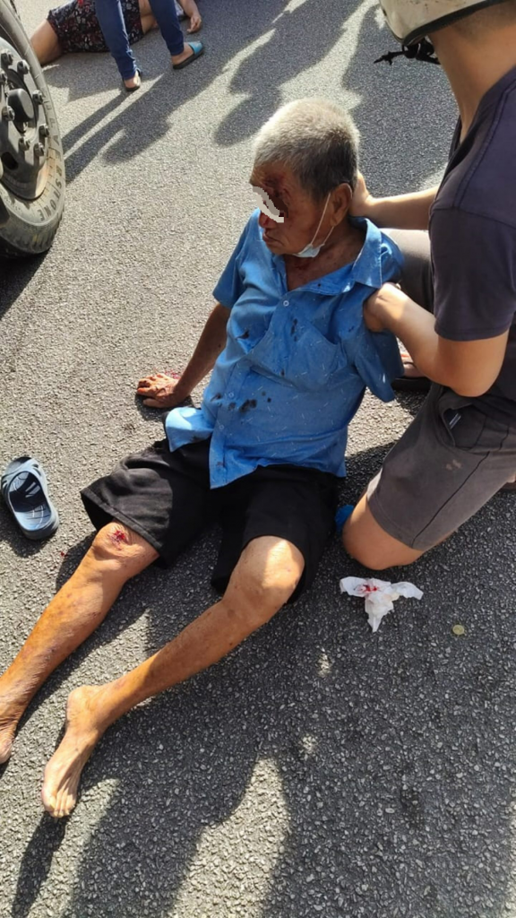 华裔男女过马路 双双遭罗里撞伤