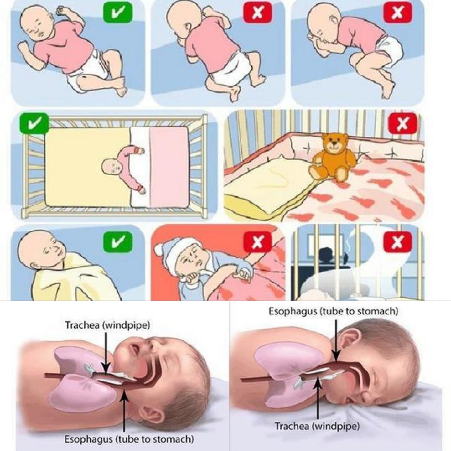 趴著睡容易引发婴儿猝死症·医生建议：1岁以下需仰睡