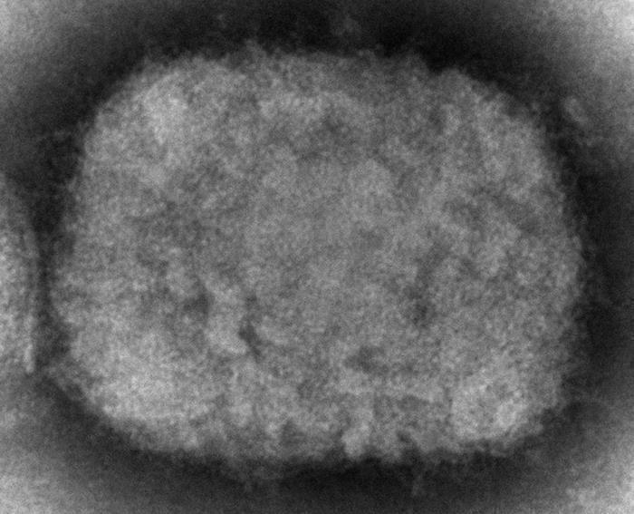 美国首次确诊儿童感染猴痘病毒 疑是家庭传播 