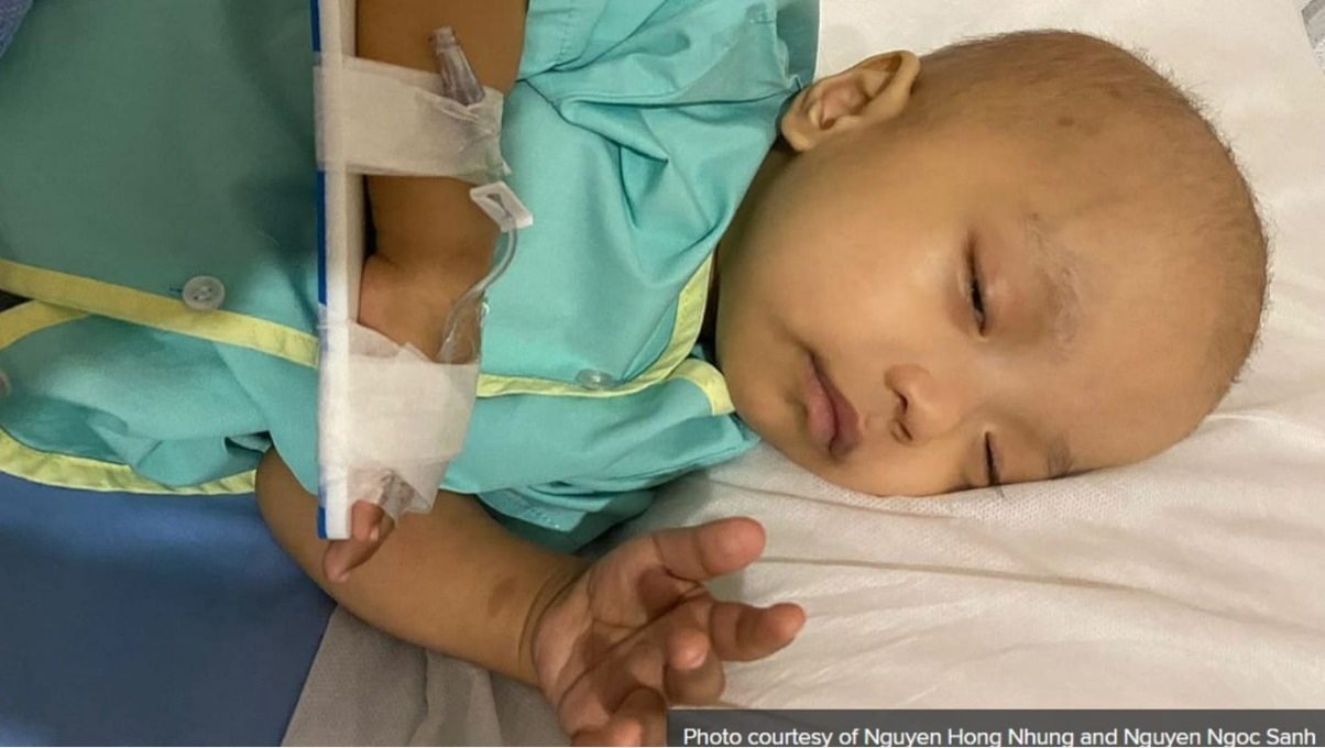 （已签发）柔：狮城二三事：未满周岁就需承受身插10管之苦，越南男婴赴新治罕见癌症