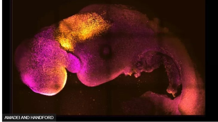拼盘 ／老鼠合成胚胎：英国剑桥科学家干细胞实验成功　有脑袋有心跳