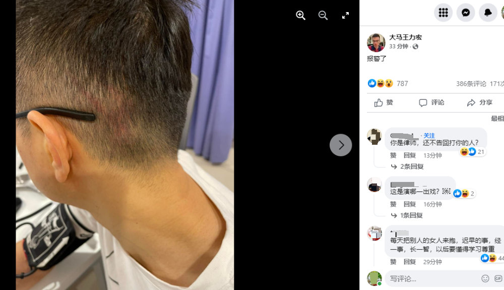 大马王力宏网红律师江昭上被殴·脸书发帖报警