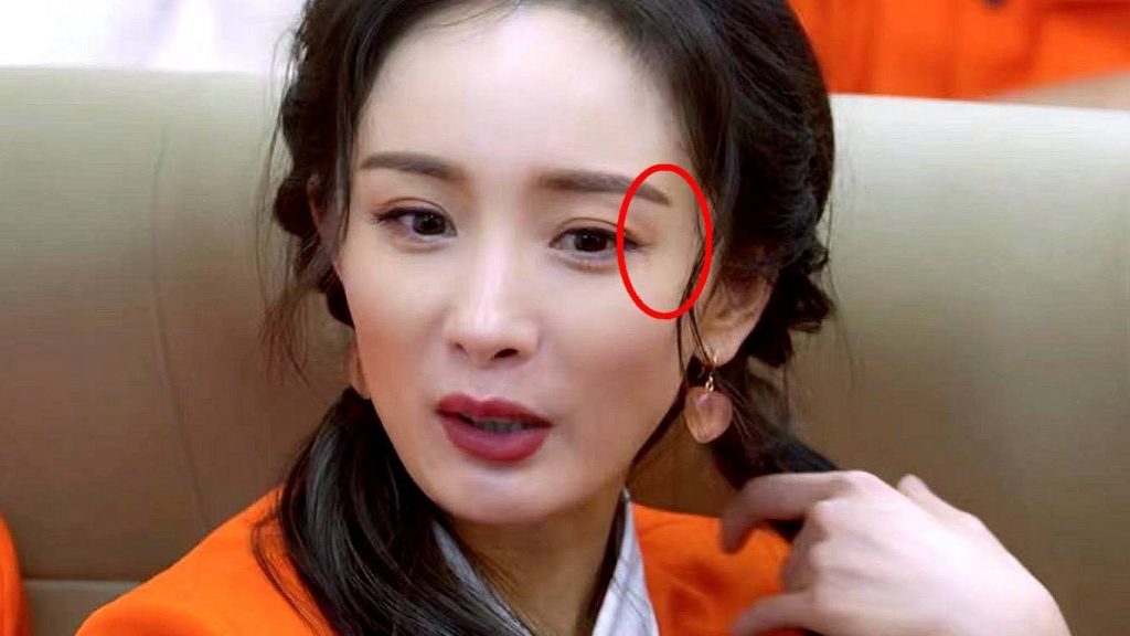 杨幂眼角受伤2个月 伤疤化妆也遮不住