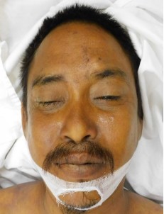 柔：身份不明男子上月过世，峇医院吁家属速领尸