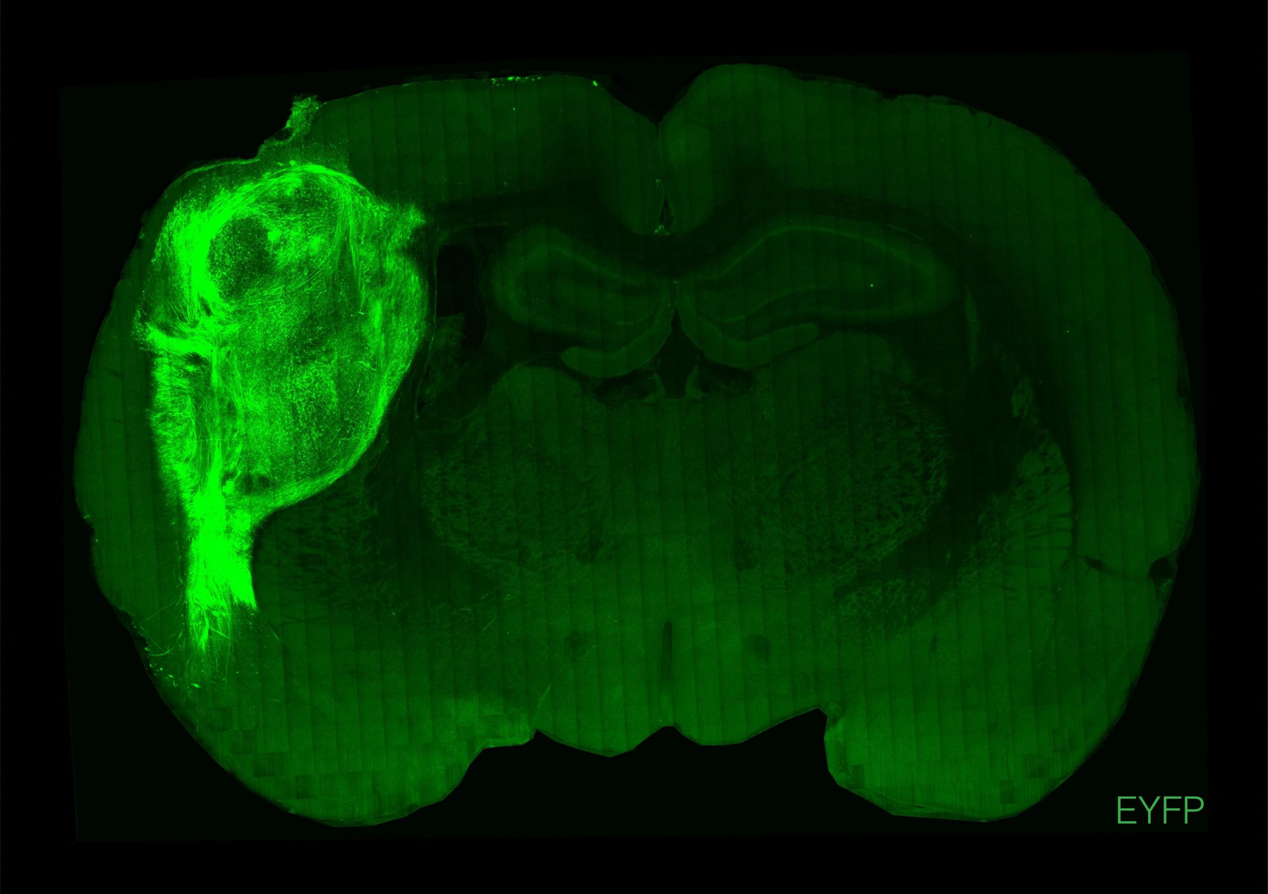 科学家：人脑细胞植入老鼠脑  开创研究精神病新方法