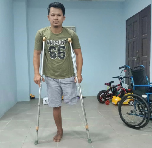 全国:路洞导致意外，男子失左腿获赔65万2000令吉。