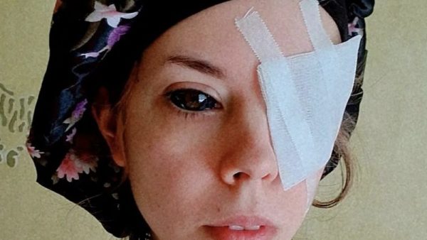 波兰女双眼刺青失明愤提告  法院判刺青师有罪