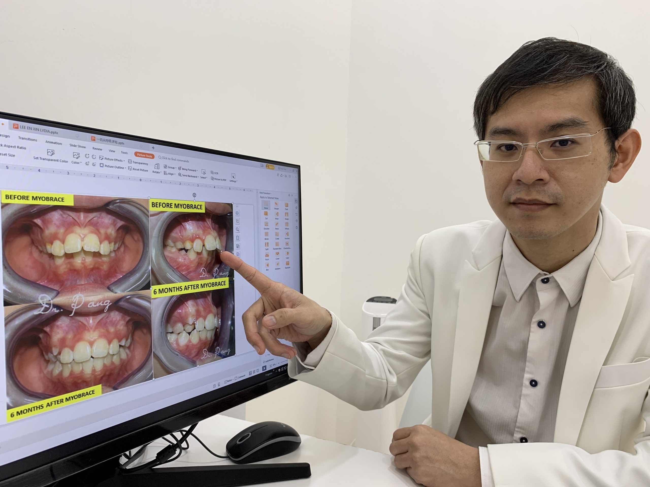 【特稿】：兔子可爱但兔牙却是不良习惯导致，牙医：及早纠正对孩童身心灵发展有益