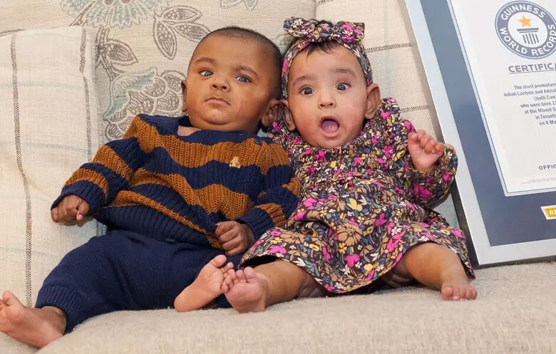 出生时被认为无法存活   世界最早产双胞胎庆周岁