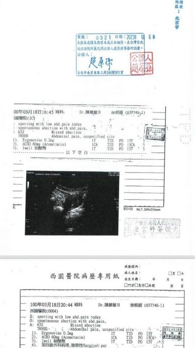 大S认了2次流产 胎死腹中术后4天嫁汪小菲