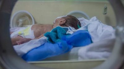 每年100万新生儿死于早产  已成儿童死亡主因