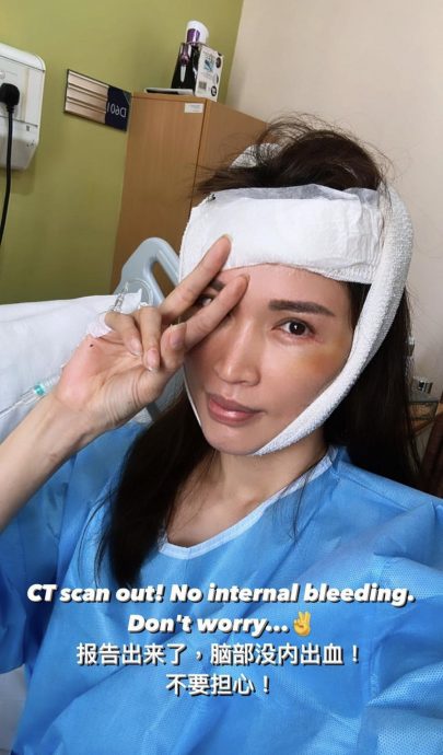 Amber Chia晕倒撞到头 入院急动手术 