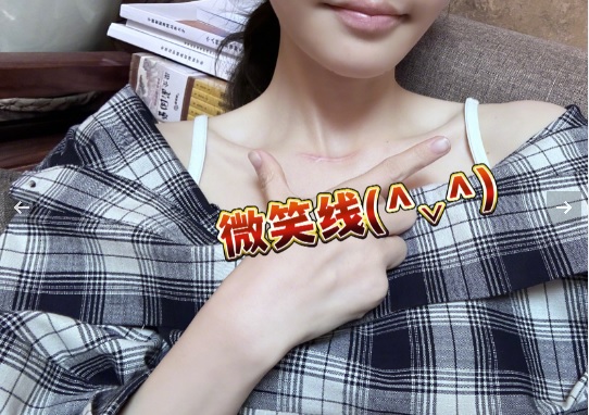“中国第一网红”自爆罹甲状腺癌“恶性晚期”  病态照爆光