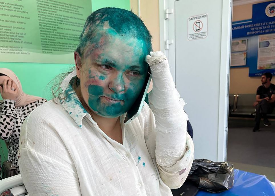 俄罗斯女记者“采访车臣”惨遭断指、泼漆、剃光头  