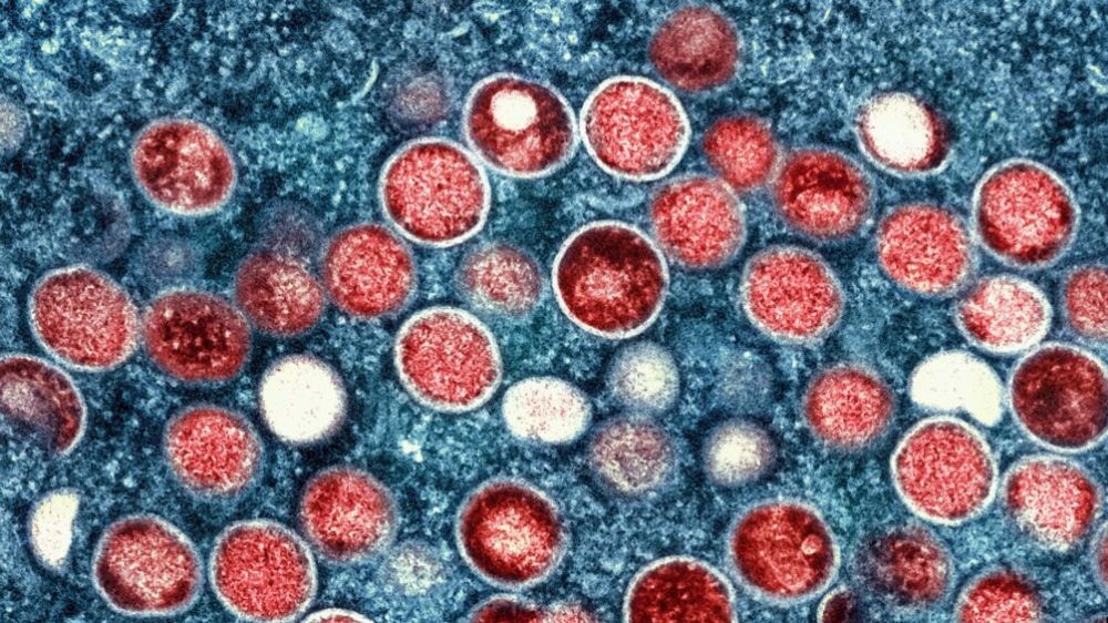 中国要求猴痘发生国人员入境 主动申报防止疫情传入