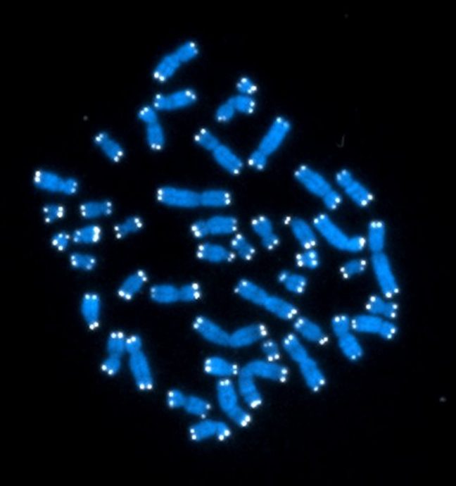 Y染色体完整测序首次公开 有助研究男性不育症