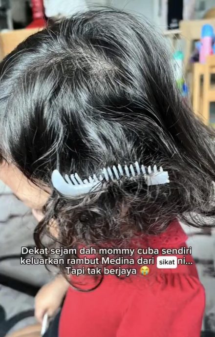 3岁女童卷发卡梳子摘不下来·母找Bomba大哥相助反被骂