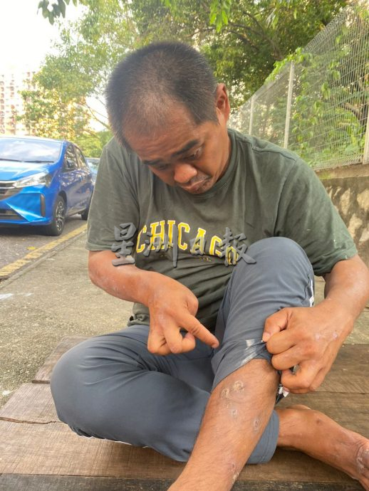  独家|马来男子求助本报  “阿强睡街满身伤 盼不到家人”  ​