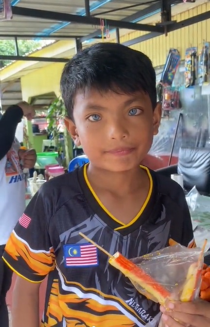 视频|9岁丹州男孩湛蓝双眸 网民：“五条悟”传人
