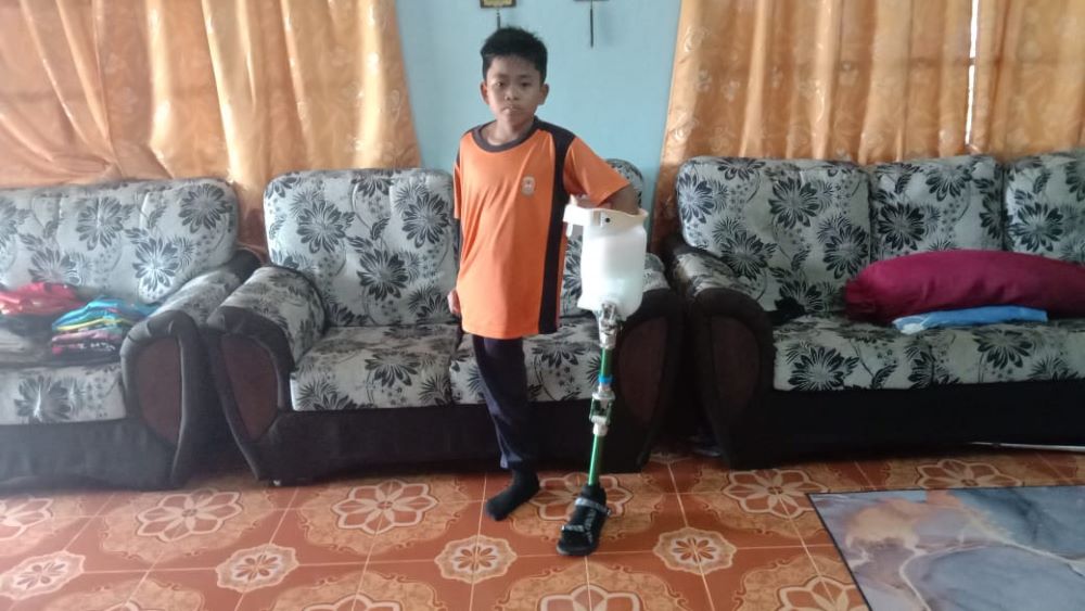 细菌感染被截肢 11岁男童喜获义肢“我要踢足球！”
