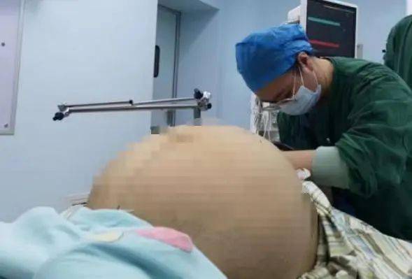 23岁未孕女子腹鼓如怀双胎　医生取出21公斤肿瘤 