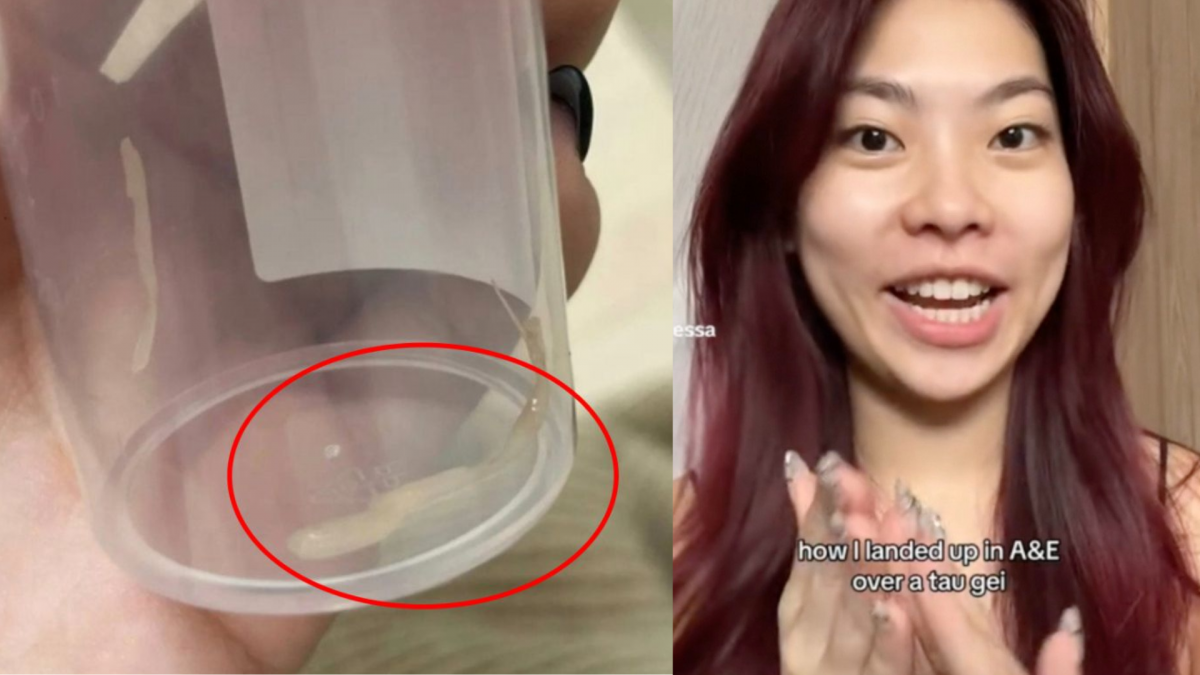 视频 | 豆芽卡喉咙9小时才挖出来 女子：医药费RM525