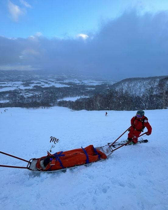 北海道滑雪左脚摔伤 高艺韧带损伤断裂