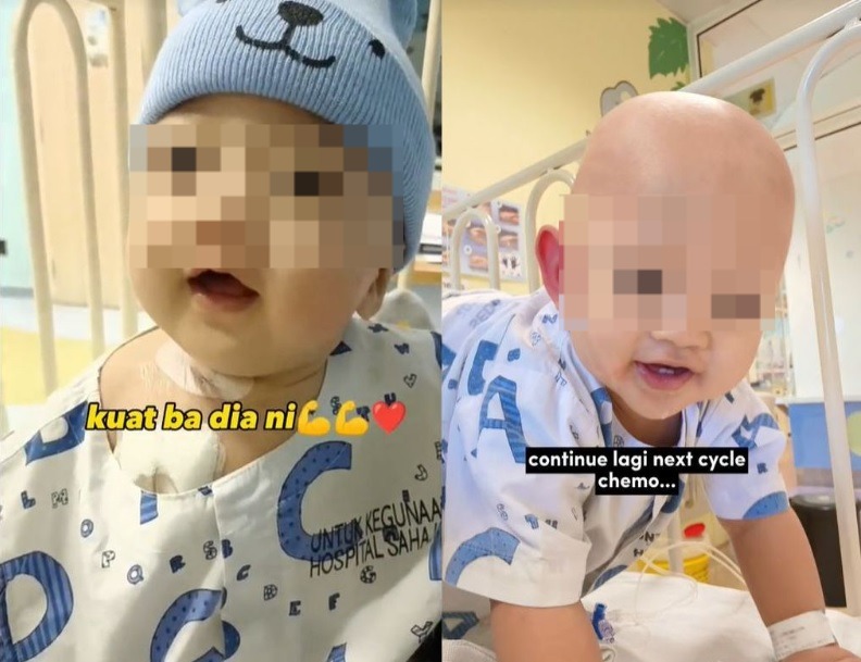 视频|9月大宝宝患眼癌 经历5次化疗+手术 母钦佩：太勇敢！