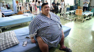More Chinese have the stomach to face life-changing gastric surgery