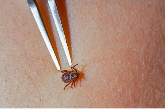 日本首次发现「蜱虫病」人传人案例　20多岁男医生遭病患感染