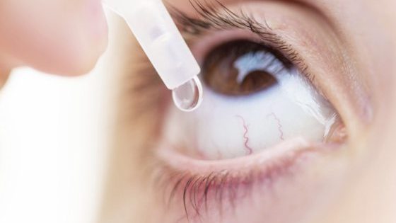 干眼增角膜溃疡风险 若结疤可酿永久性伤害
