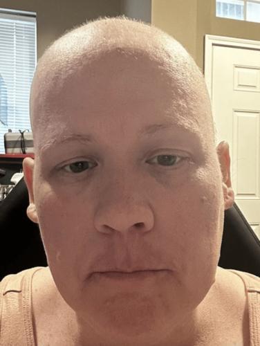 拚图)美国妇确诊超罕见癌症  化疗折磨掉光头发后被告知从未得病