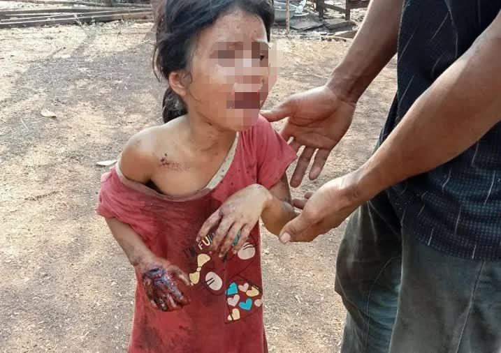 森林发现地雷突爆炸 4村民惨死母女受伤