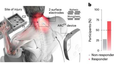 醫療科技新創“脊髓電療法”　讓癱瘓病患重拾希望