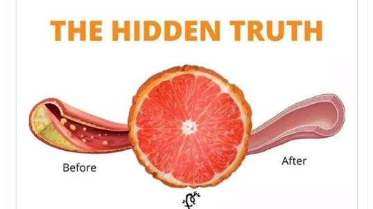 每天1葡萄柚除动脉斑块？ 研究：言过其实